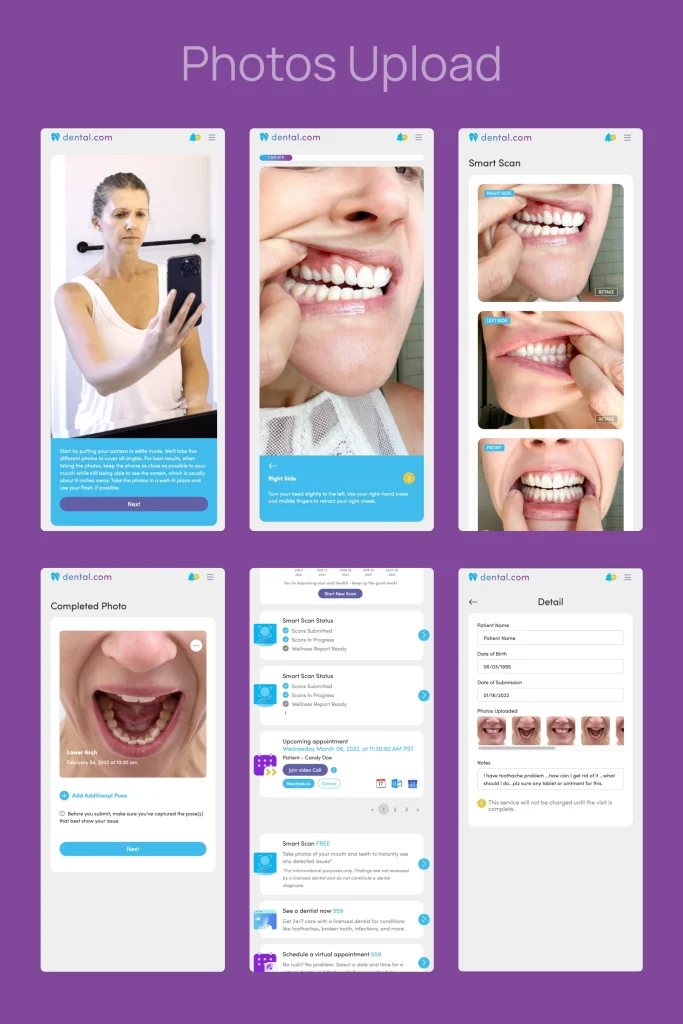 photo upload for dental ai review